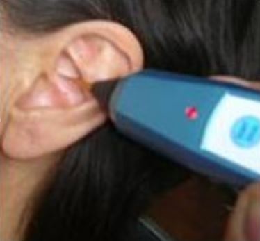 Auricular (Ear) Laser Therapy